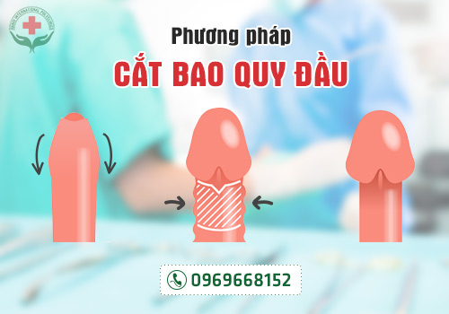 dai-bao-quy-dau-co-quan-he-duoc-khong-cach-khac-phuc