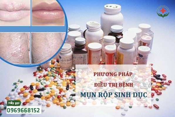 dieu-tri-mun-rop-sinh-duc-o-dau-uy-tin-nhat