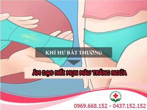 hoang-hot-cho-ay-bi-noi-dom-trang-phai-lam-sao