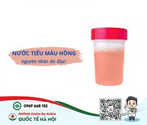 Nguyên nhân nước tiểu có màu hồng